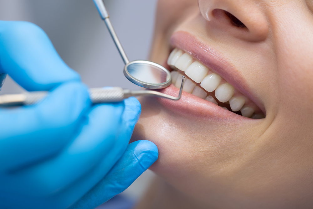 Kızılay Diş Doktorları: Diş Sağlığınız İçin Profesyonel Hizmet